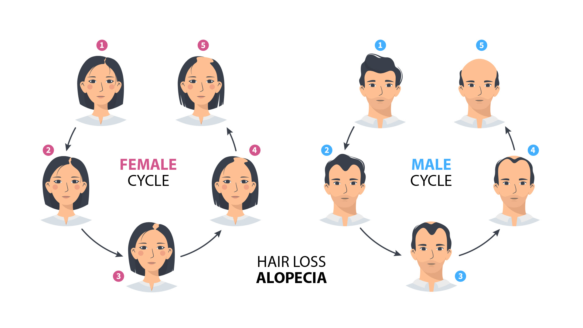 Hair Loss Alopecia Cycle